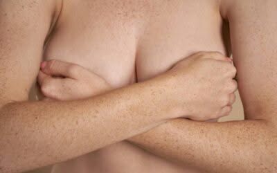 5 Breast Augmentation Options Compared: Which One Fits Your Goals?